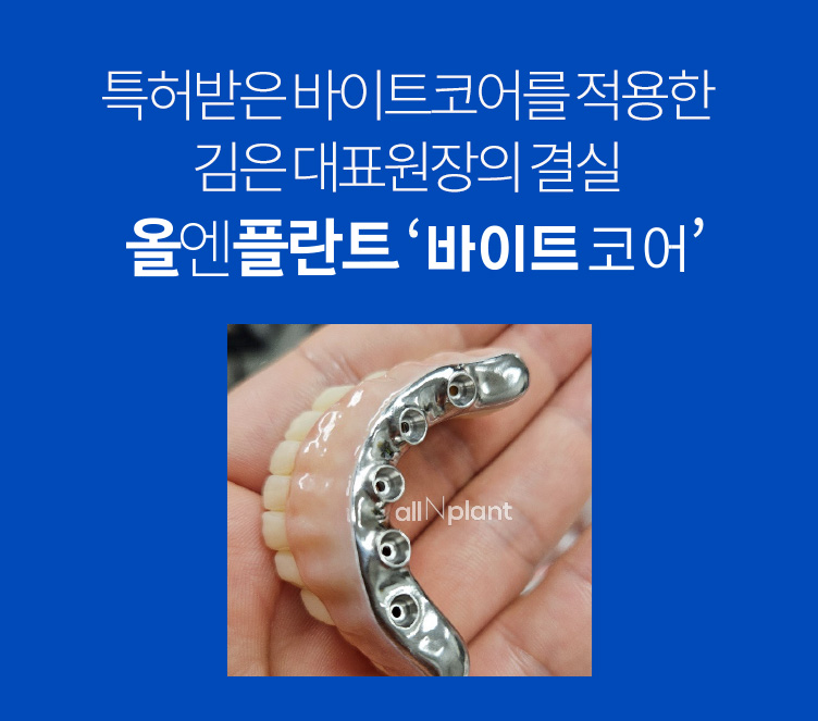 특허받은 바이트코어를 적용한 김은 대표원장의 결실 올엔플란트 ‘바이트코어’